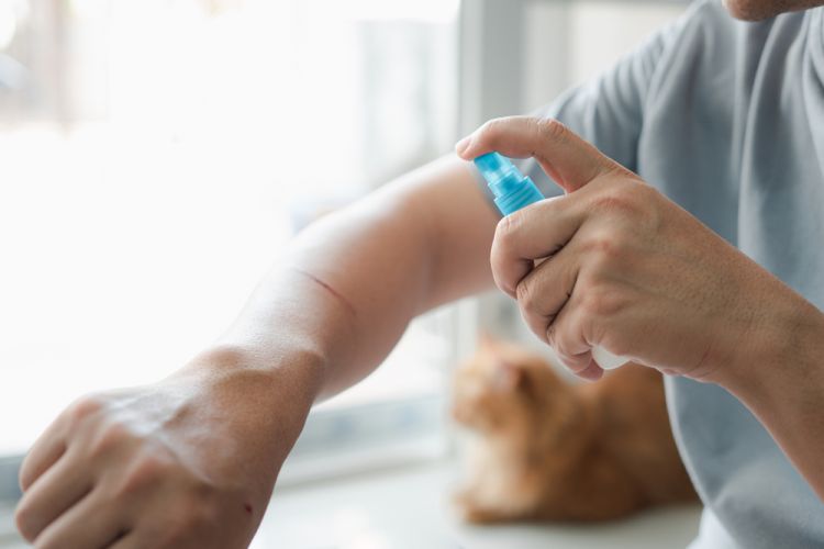 Kā pareizi dezinficēt brūci jeb Jodam un briljantzaļajam – nē!