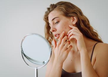 Dermatoloģe brīdina: ne katrs tumšais plankums uz ādas ir tikai pigmentācija
